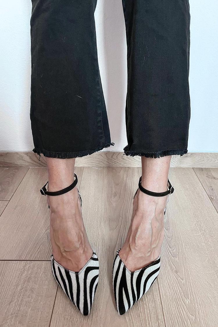 Chic Zebra-Print Pumps with Ankle Strap
